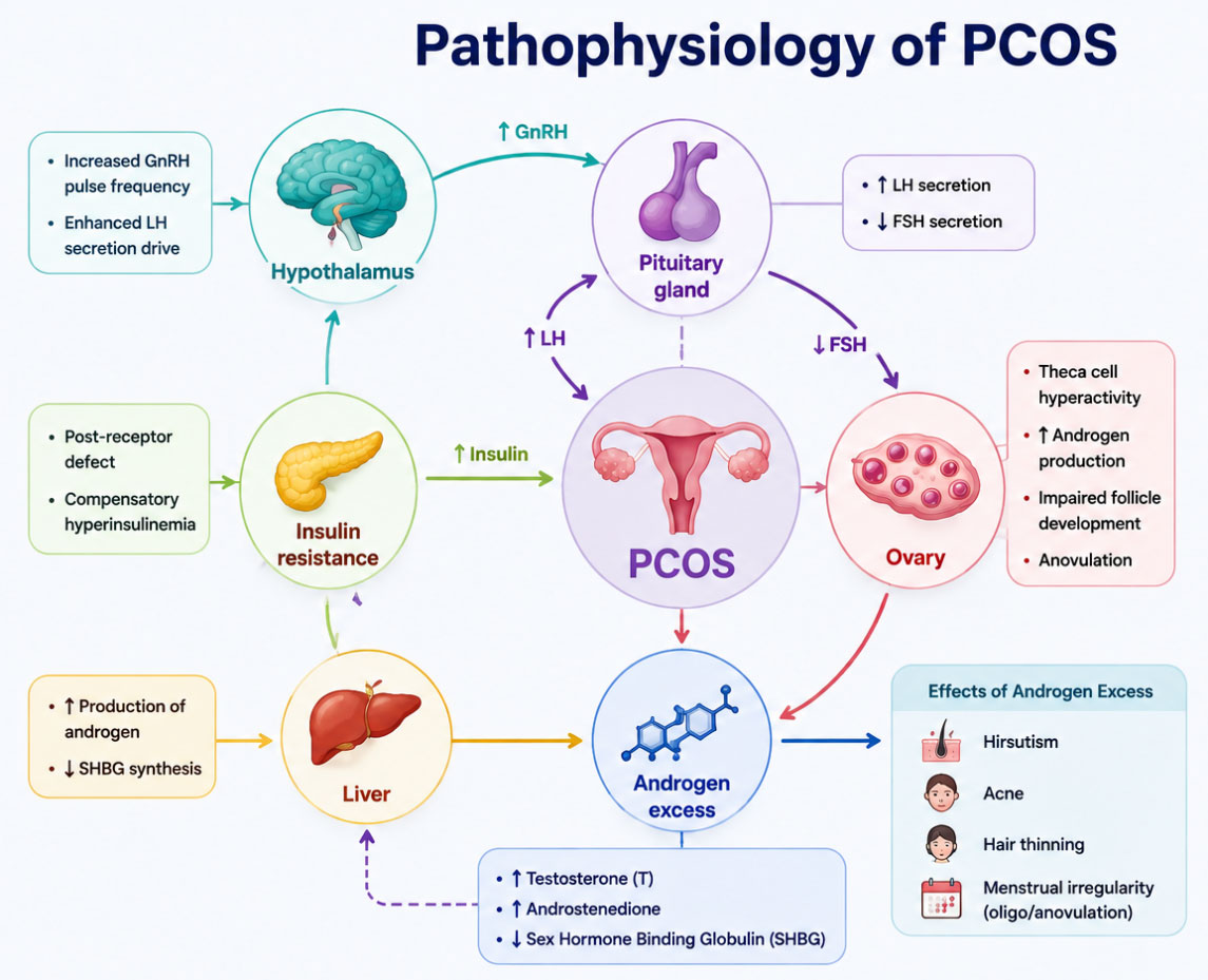 Automated PCOS Disease Detection Using Clinical and Diagnostic Features