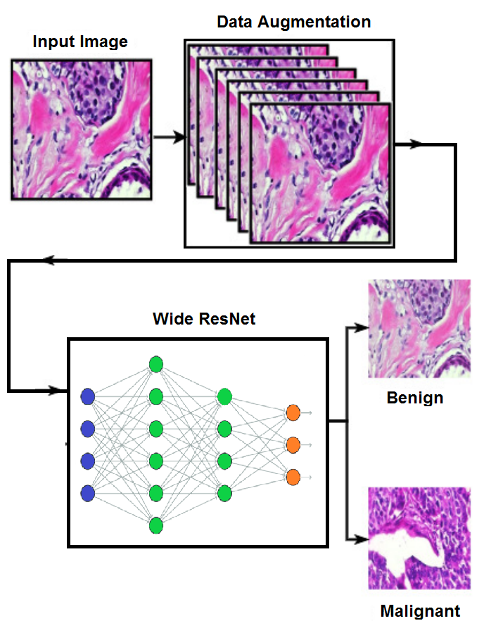 Application and Deployment of a Fine-Tuned Pre-trained Deep Model for Breast Cancer Classification