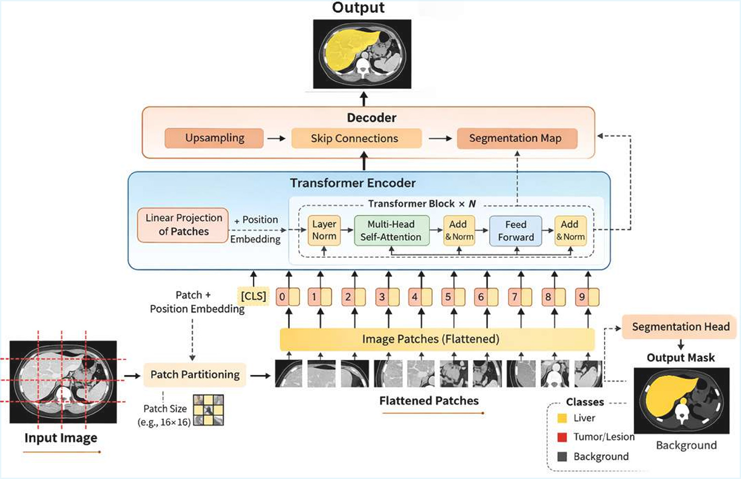 A Comprehensive Review on 3D Volumetric CT Liver Segmentation: Techniques, Challenges, Trends, and Future Research Directions