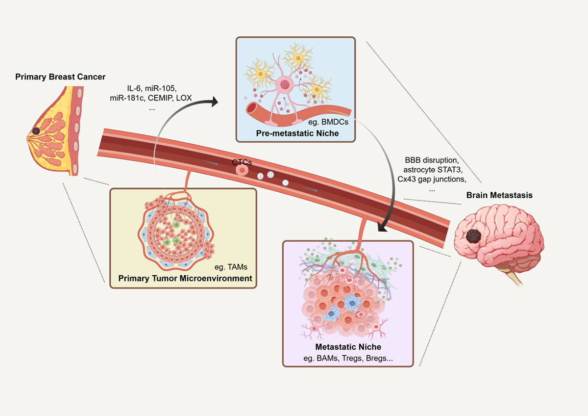 A Tri-Phasic View of the Microenvironment in Breast Cancer Brain Metastasis