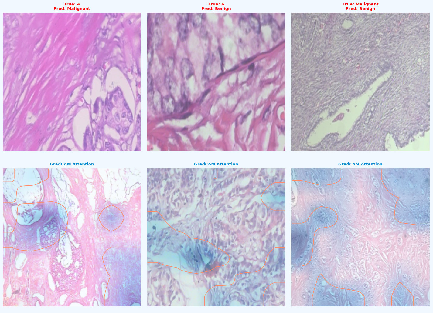Multi-Scale CSPResNet50 with Feature Pyramid Aggregation and SE Attention for Breast Cancer Histopathological Subtype Classification and Malignancy Detection
