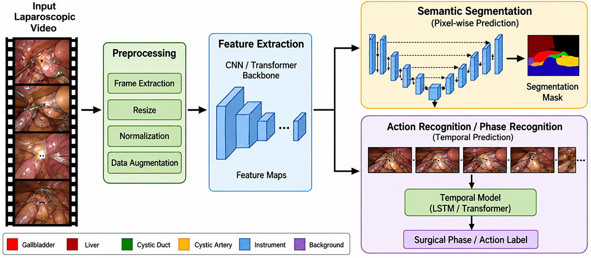 Deep Learning-Based Segmentation, Action, and Phase Recognition in Laparoscopic Cholecystectomy: A Review