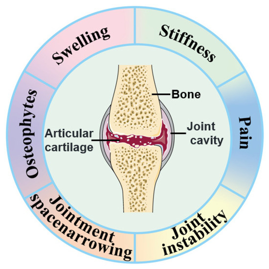 Nanotechnology and Cartilage Regeneration: A Review