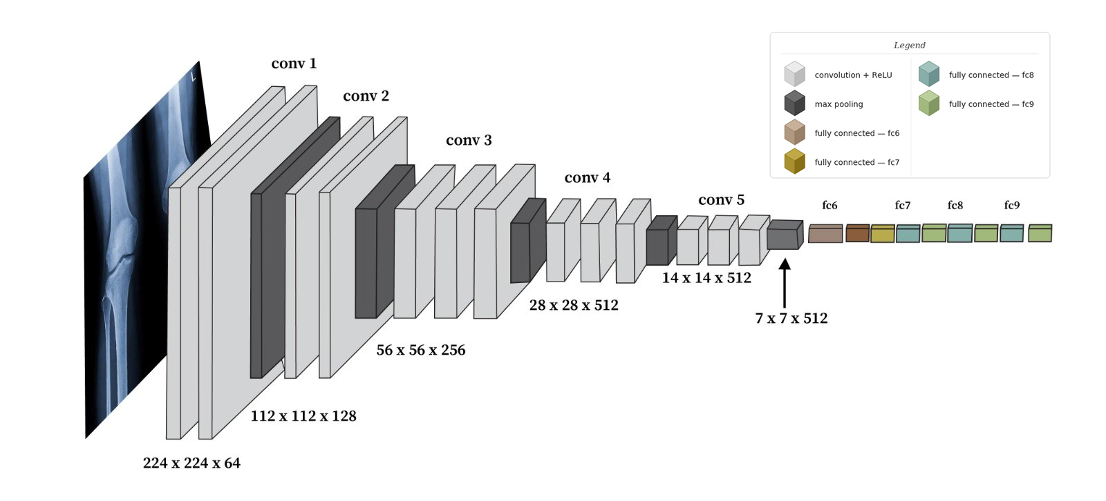 Comparative Analysis of Automated Knee Osteoarthritis Severity Classification from X-Ray Images Using CNNs and VGG16 Architecture