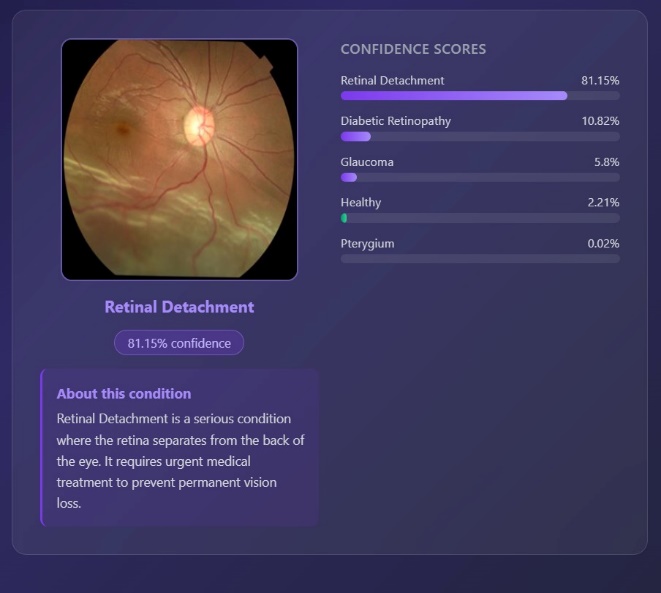 An Intelligent and Secure Application for Early Detection of Eye Disease