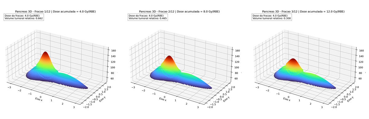 Carbon Ion Hadron Therapy: Analytical Formulation of Tumor Regression in Pancreatic Cancer by Computed Tomography