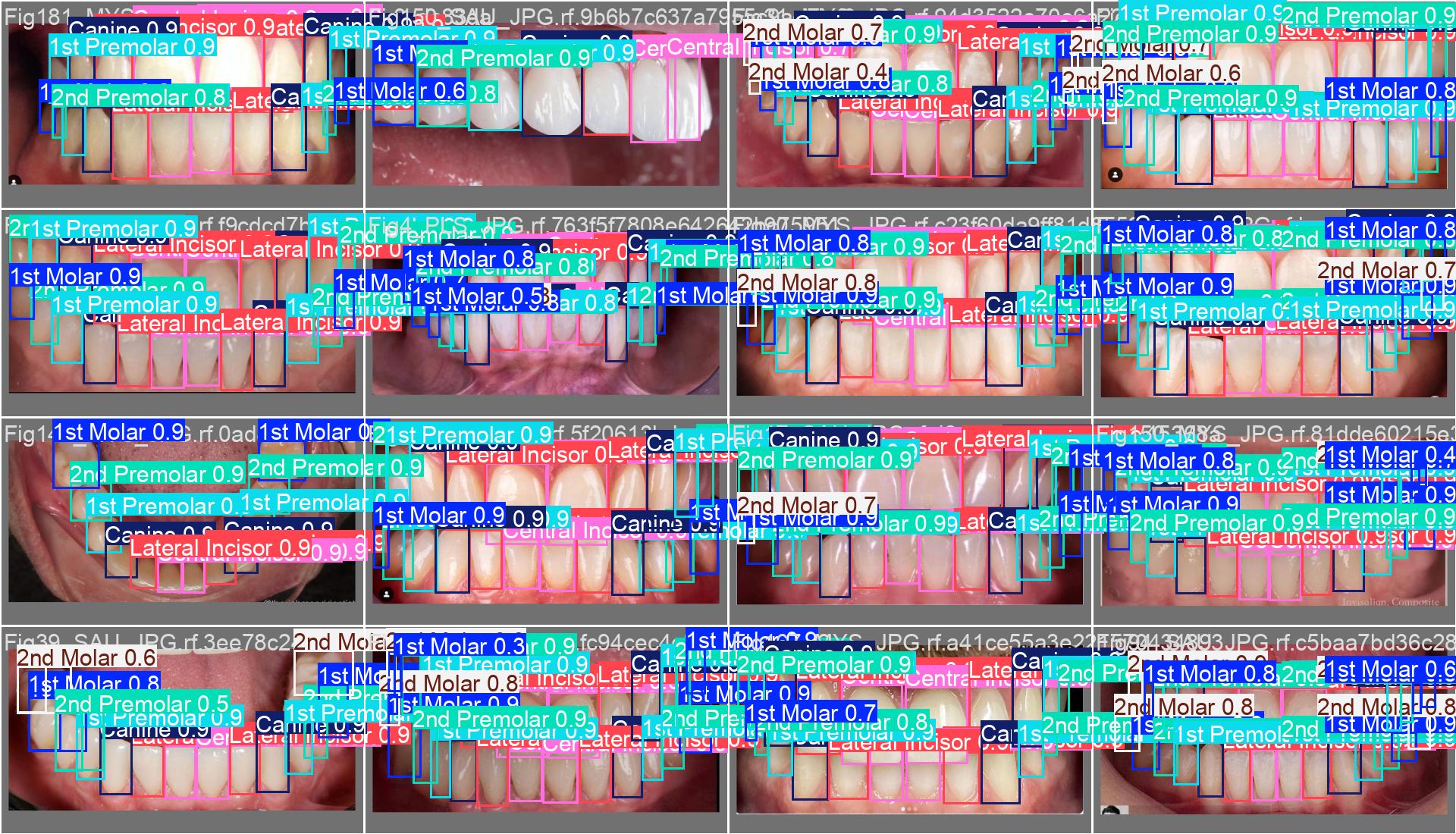 Dental Classes Classification using TEYOLOv8 Network