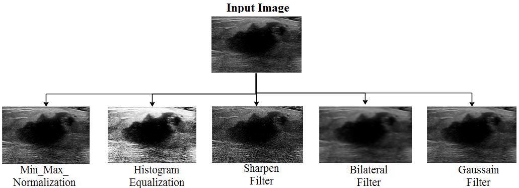 Recent Advances in Breast Cancer Detection: A Review on Segmentation and Classification Techniques