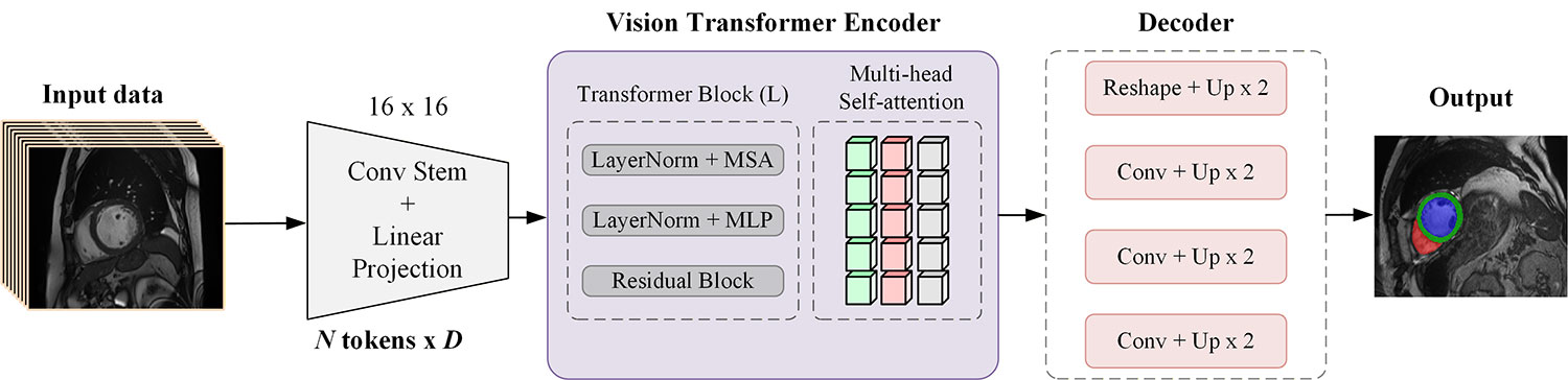 Global Self-Attention for Cardiac MRI: Unified Segmentation and Interpretable Pathology Diagnosis