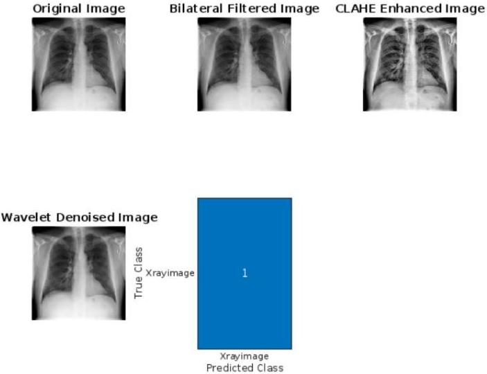 Evaluating the Impact of Image Enhancement Techniques on Deep Learning-Based X-ray Classification