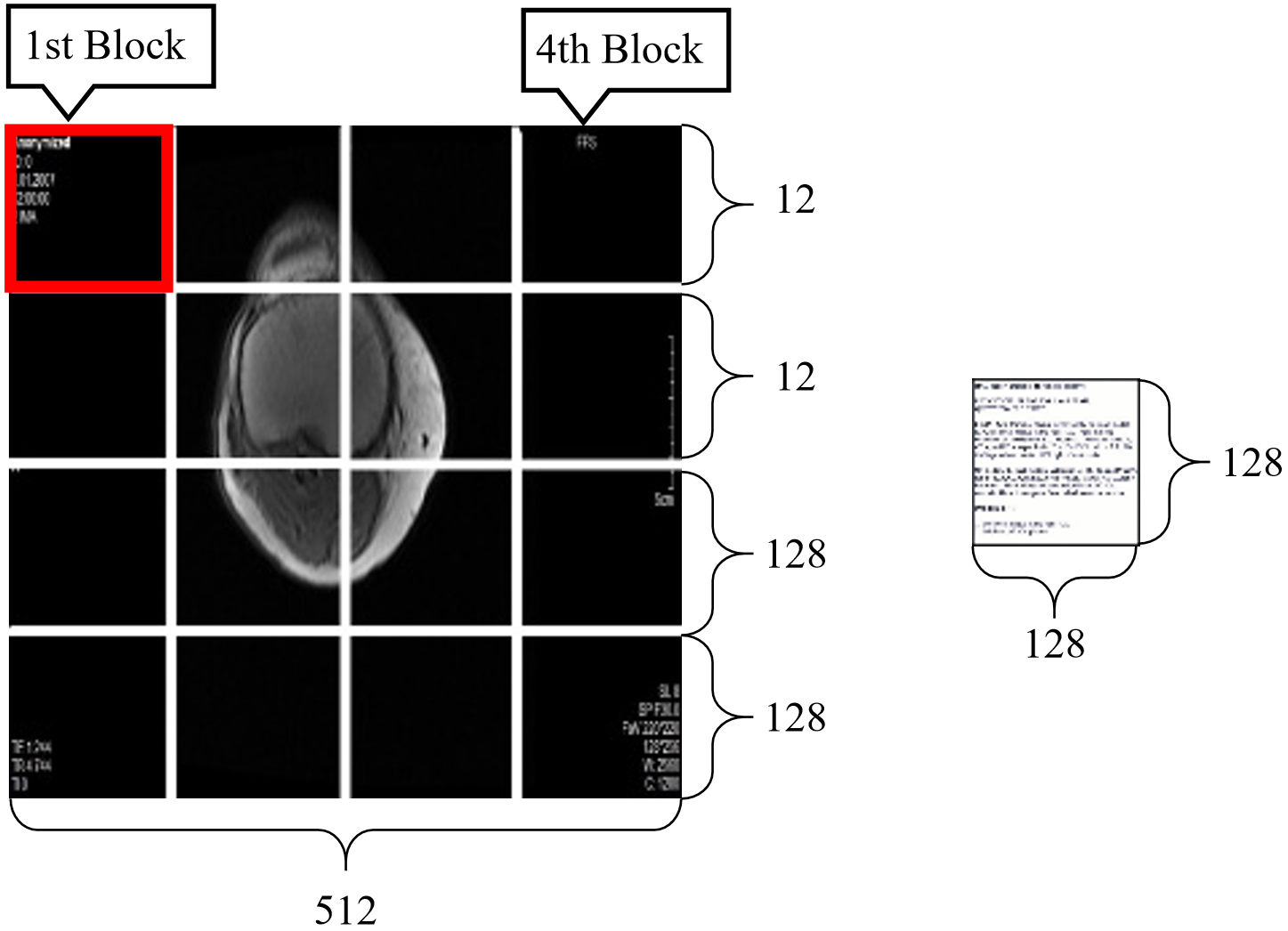 DCT-SVD Based Hybrid Approach for Digital Watermarking of Medical Images