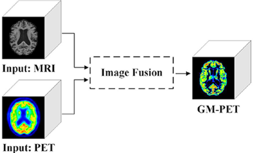 A Recent Survey on Multi-modal Medical Image Fusion
